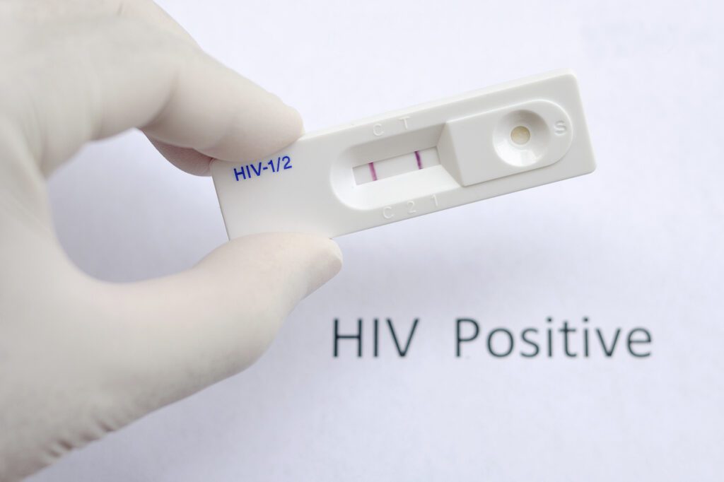 Doctor reading the results of a HIV positive test image