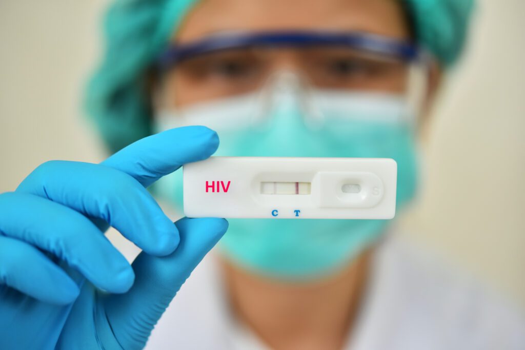Lab technician holding HIV rapid device test image
